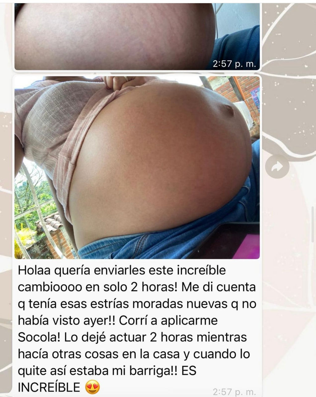Kit estrias